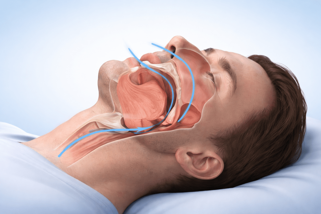 What Happens When Sleep Apnoea Goes Untreated? 