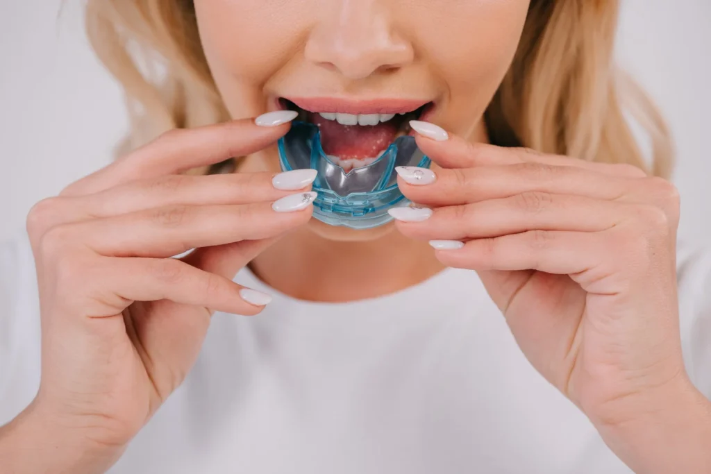 The person in the image is holding a clear oral appliance that fits over the teeth, which is characteristic of MAS devices.